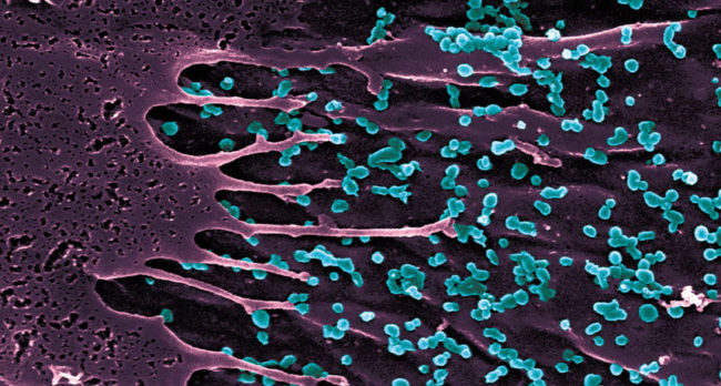 860-banner-chikungunya-feature-Institut-Pasteur_23028-2