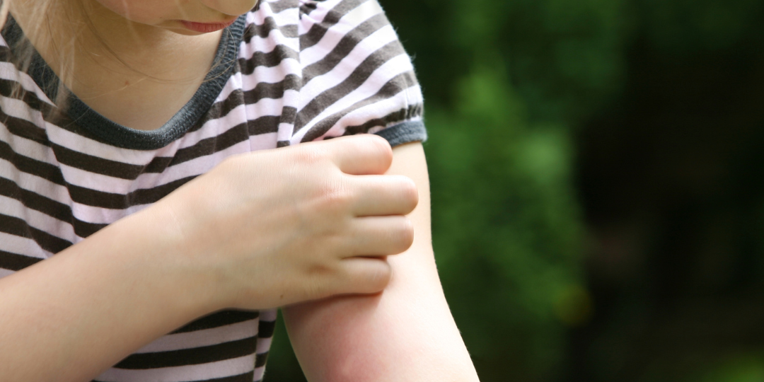 Natural Pest Control Methods You Can Easily Find at Home