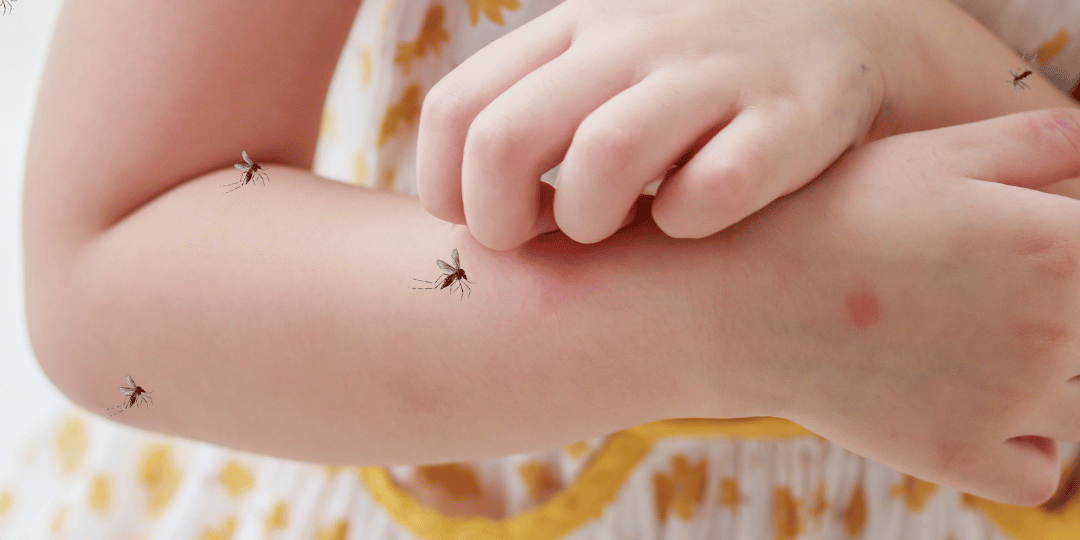 MNX_Atlanta_July_Blog1